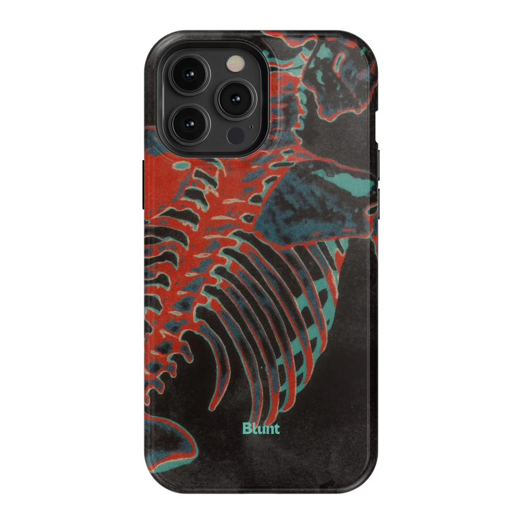 Bone Shredder iPhone Case