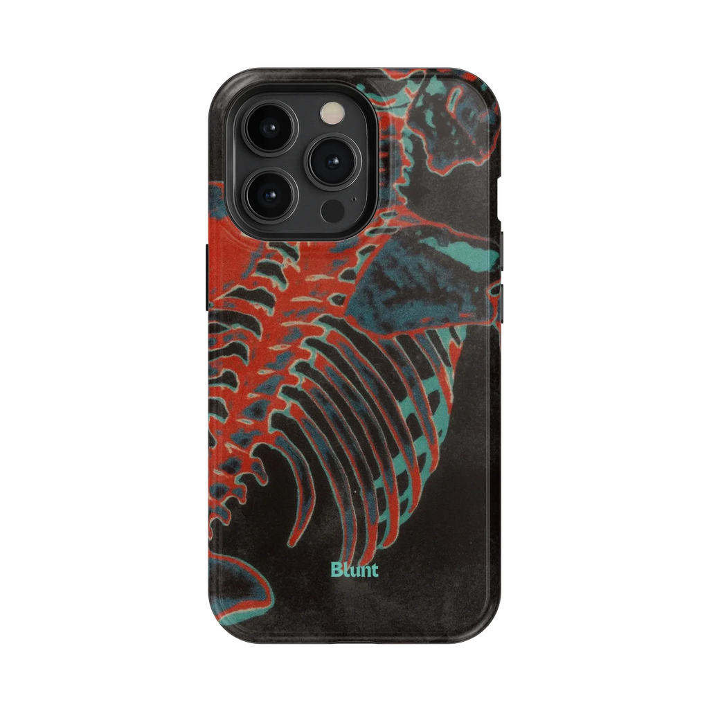Bone Shredder iPhone Case