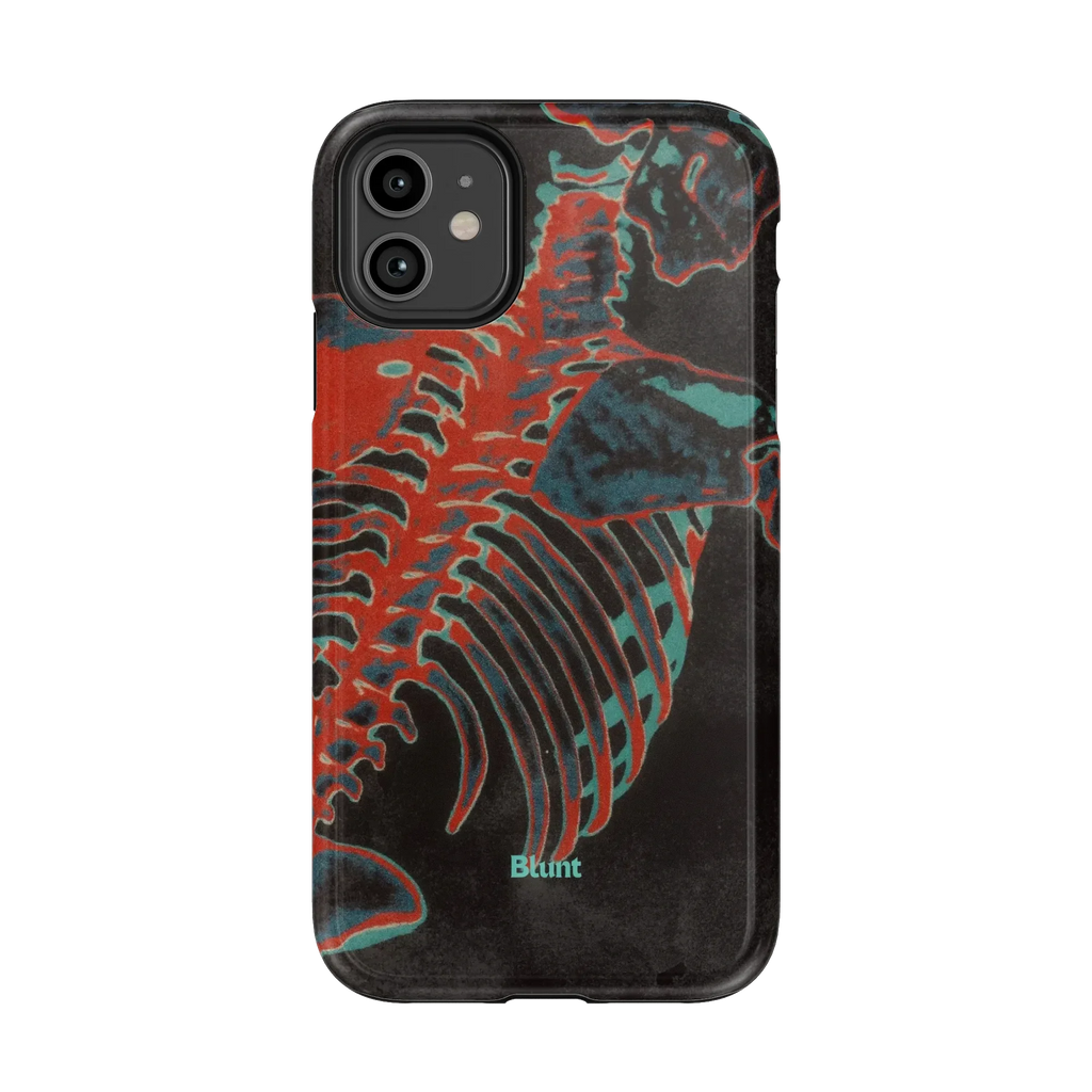 Bone Shredder iPhone Case