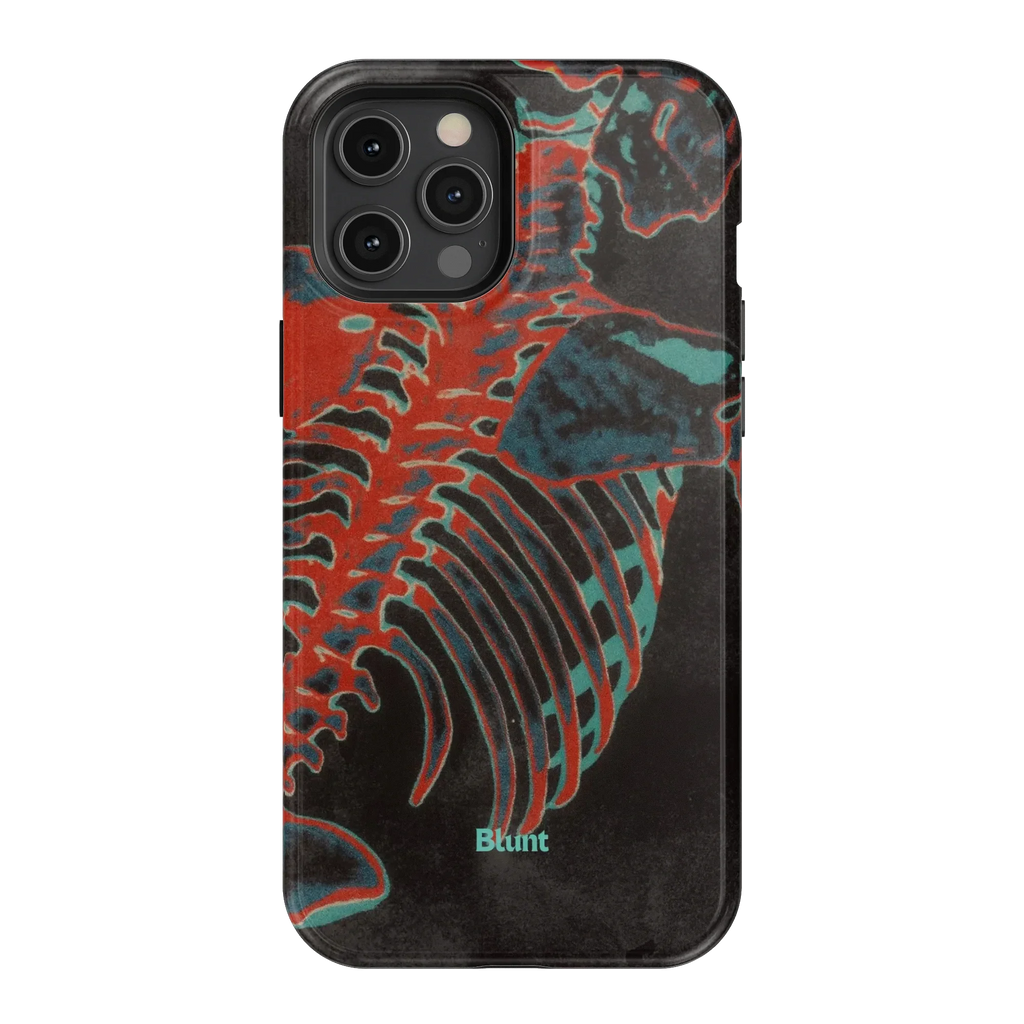 Bone Shredder iPhone Case