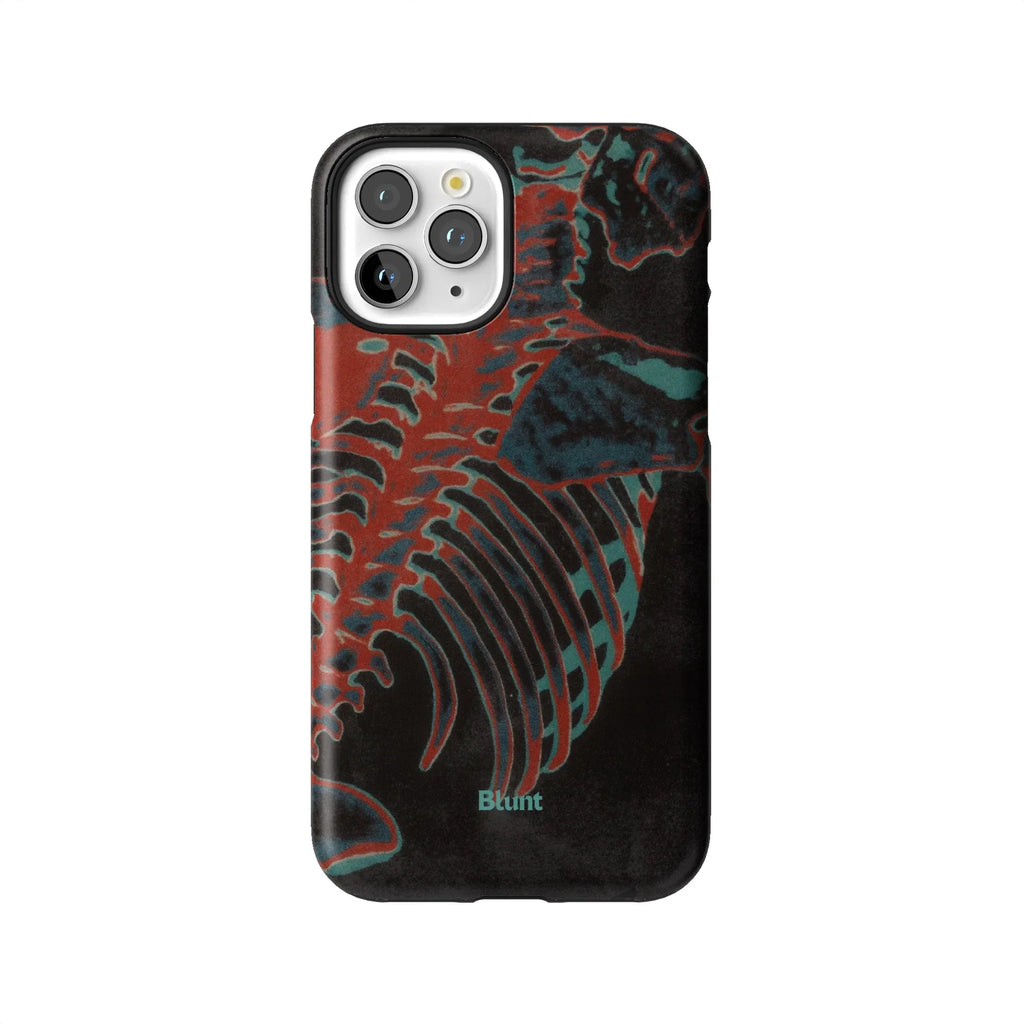 Bone Shredder iPhone Case