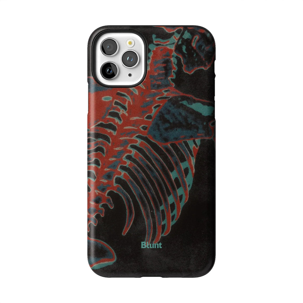 Bone Shredder iPhone Case