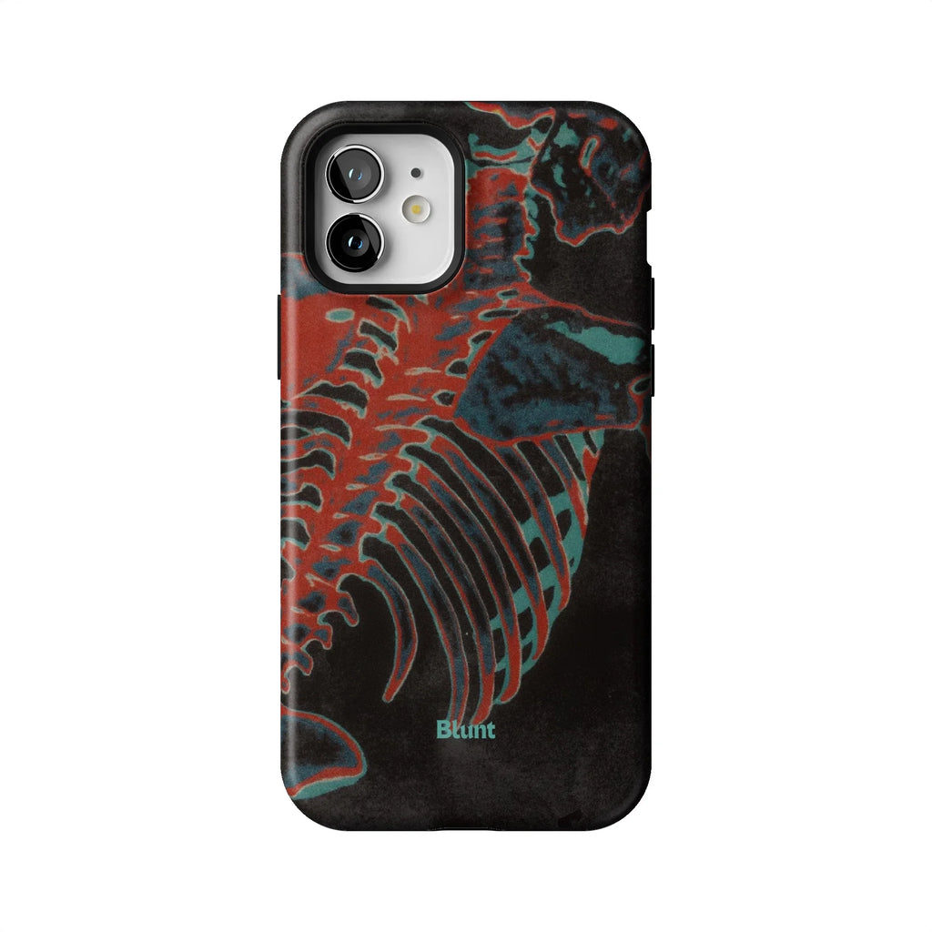 Bone Shredder iPhone Case