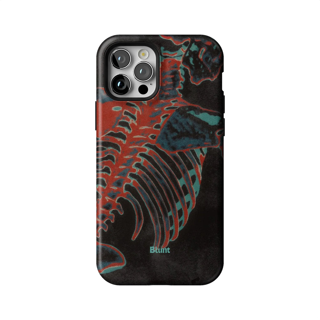 Bone Shredder iPhone Case