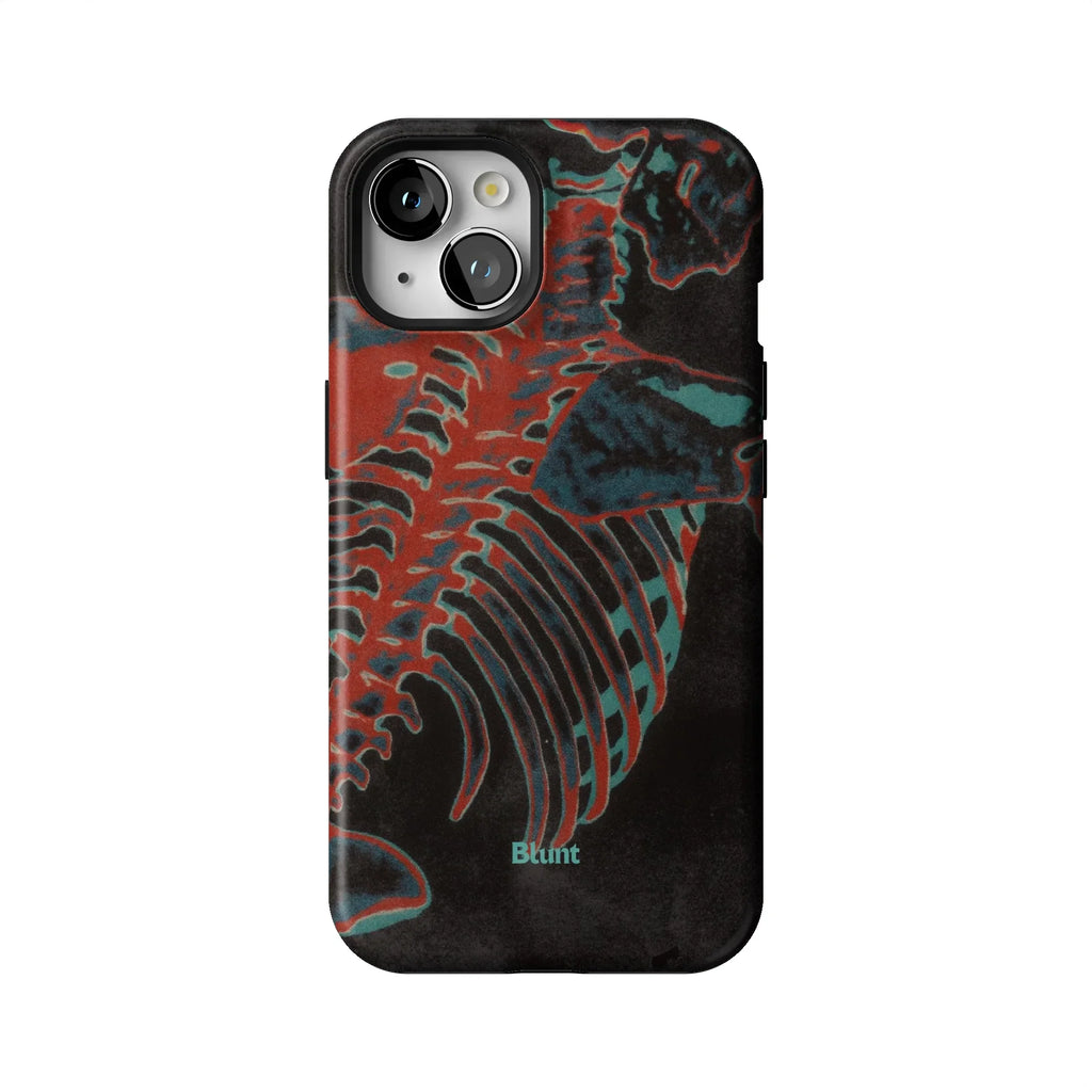 Bone Shredder iPhone Case