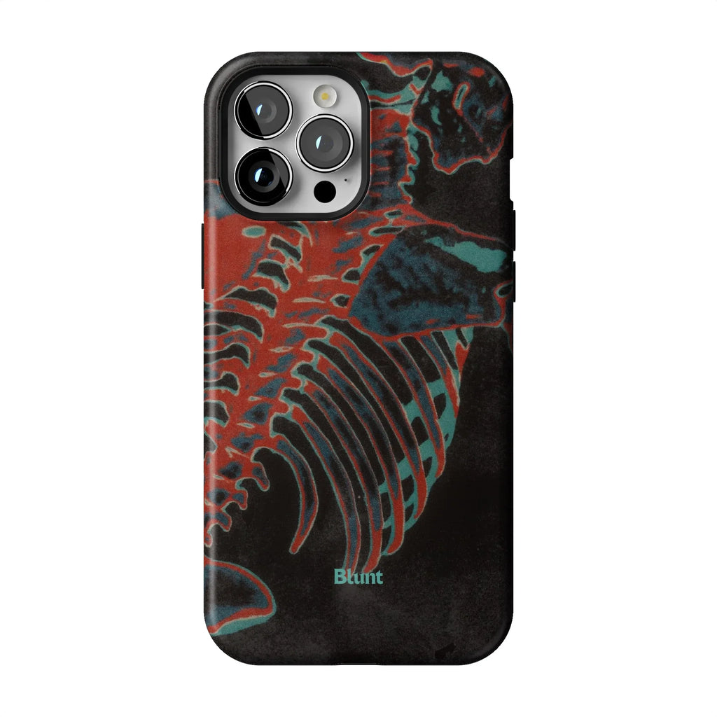 Bone Shredder iPhone Case