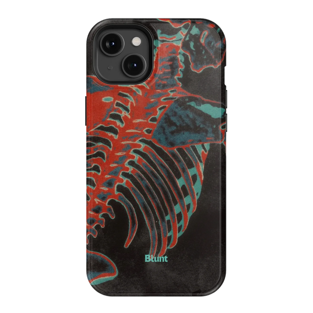Bone Shredder iPhone Case